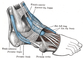 Jambe gauche douloureuse