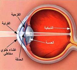 المياة البيضاء