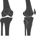 Anterior and lateral view of knee.