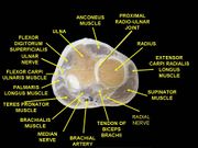 Muscles of upper limb. Cross section.