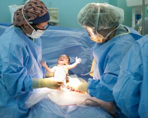 طفل بعد ولادته قيصريا.jpg