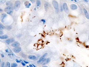 Immunohistochemical detection of Helicobacter (1) histopatholgy.jpg