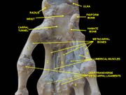 Wrist joint. Deep dissection.Anterior, palmar, view.