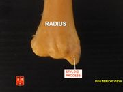 الكعبرة، ulnar notch - posterior view