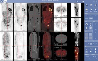 Viewer medecine nucleaire keosys.JPG