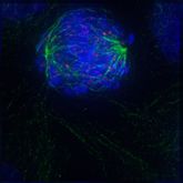 Early prometaphase: The nuclear envelope has just disintegrated, allowing the microtubules to quickly interact with the kinetochores on the chromosomes, which have just condensed.