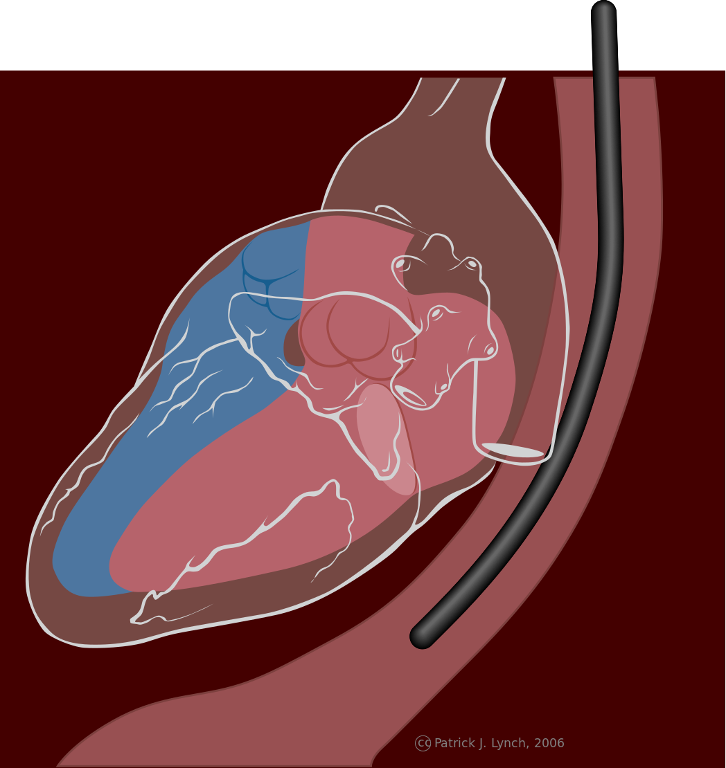 transesophageal-echocardiogram-amelia-heart-vascular-center