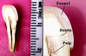 Labeledandfulltooth.jpg