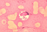 Leishmania donovani 01.png