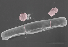 Pennate diatom from an Arctic meltpond, infected with two chytrid-like fungal pathogens. Scale bar = 10 µm.[70]