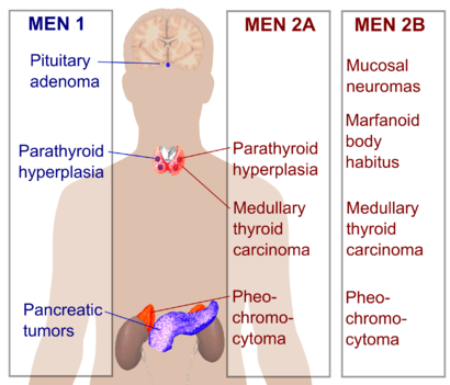 Multiple endocrine neoplasia.png