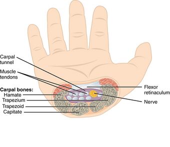 815 The Carpal Tunnel.jpg