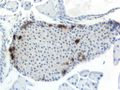 Mouse islet immunostained for pancreatic polypeptide