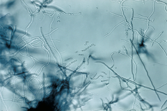 Streptomyces sp 01.png