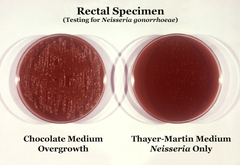 Neisseria gonorrhoeae 01.png